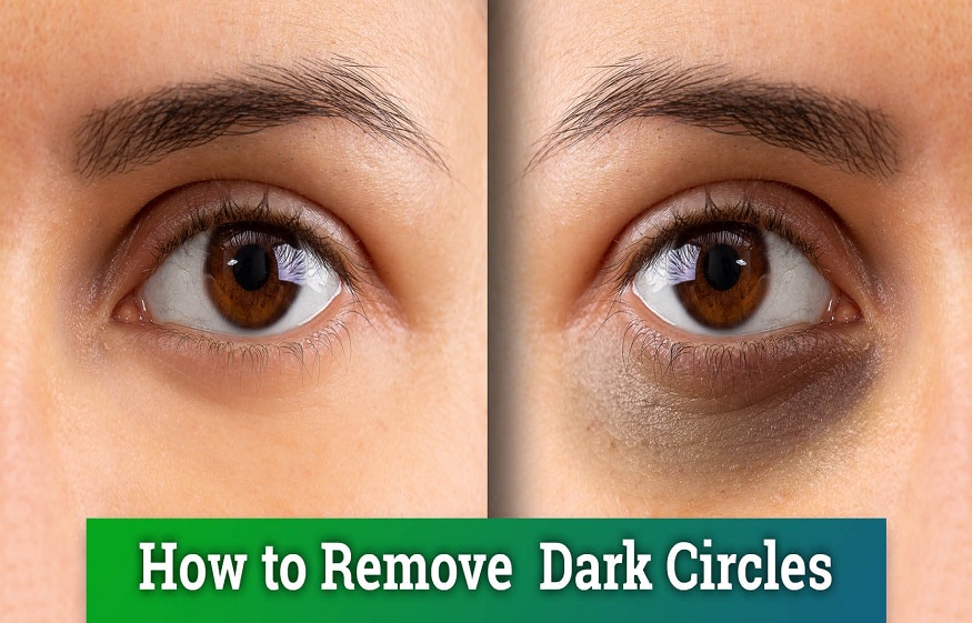 fight dark circles