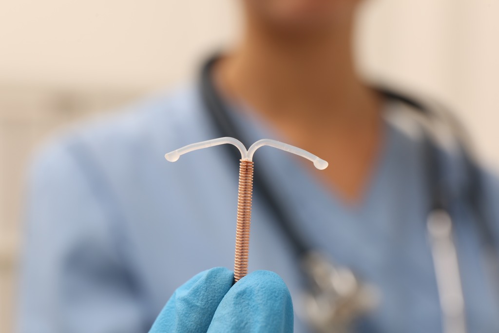 IUD Insertion