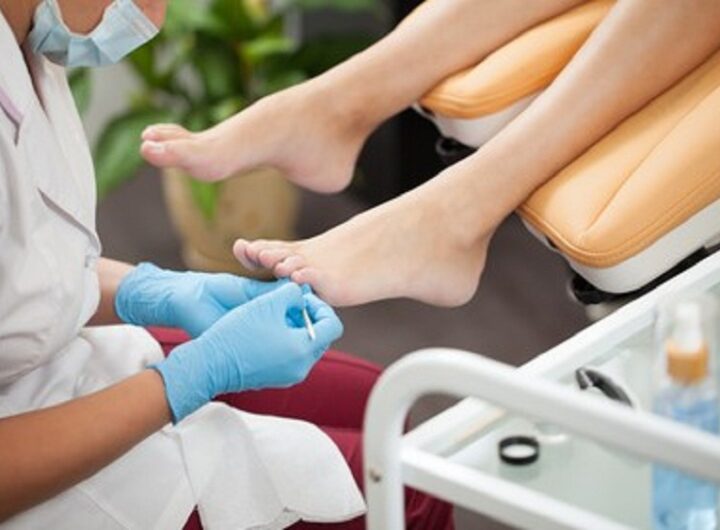 Addressing Foot Complications