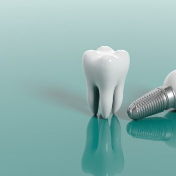 Dental implants