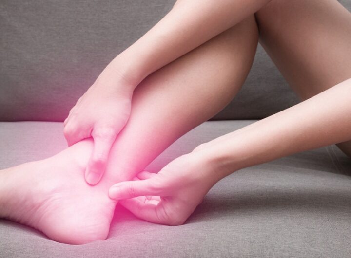 Treating Achilles Tendon Injuries