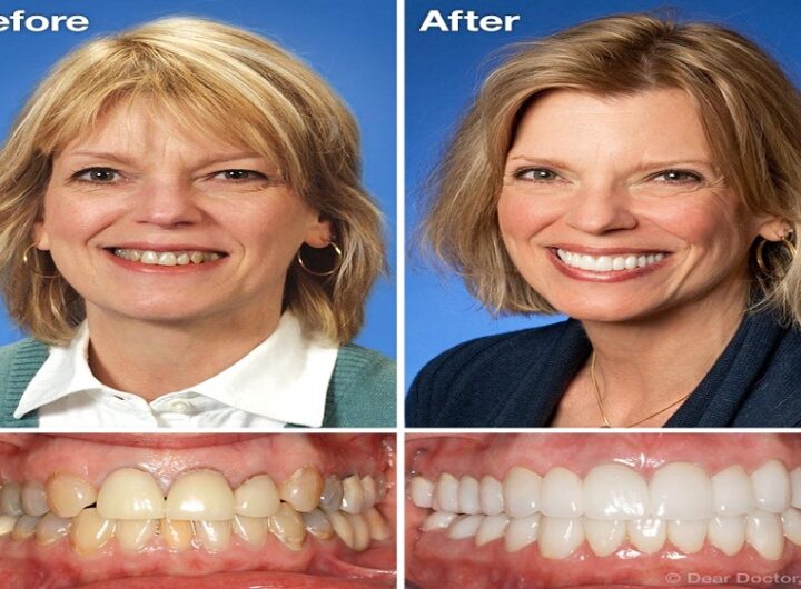 Cosmetic Dentistry