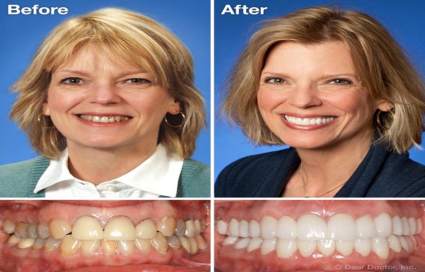 Cosmetic Dentistry