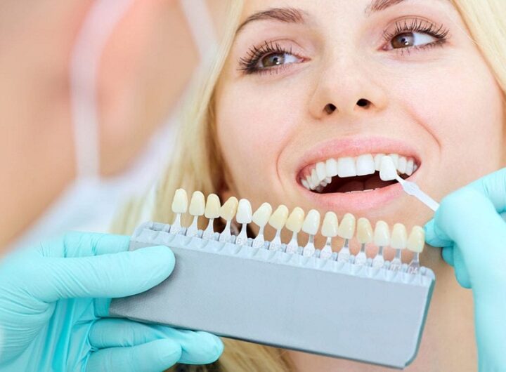 Cosmetic Dentist