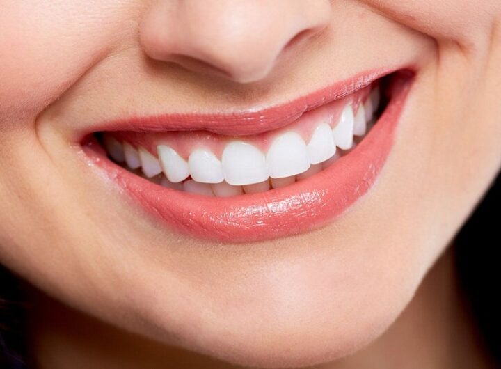 Cosmetic Dentistry For Your Smile