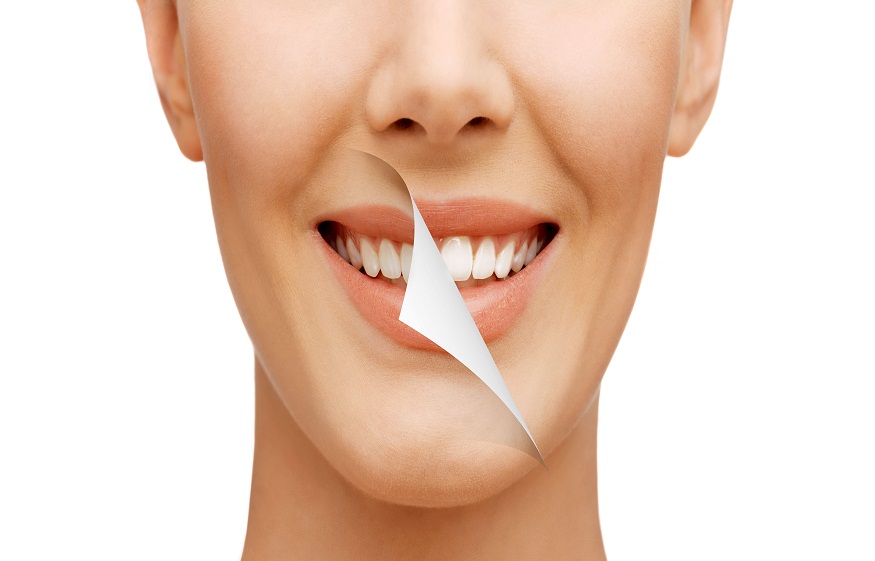 Cosmetic Dentistry